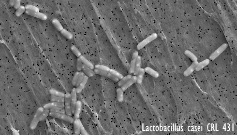 Probiotische bacterie Lactobacillus casei CRL431 remt misschien uitgezaaide borstkanker