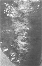 Afgestorven weefsel in de hartspier van een anabolengebruiker