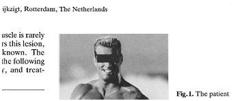 Website over afgescheurde pecs