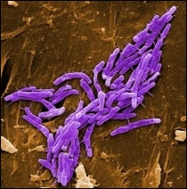 Mycobacterium fortuitum