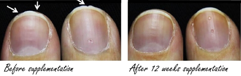 Gelatinehydrolisaat Verisol maakt brosse nagels weer gezond